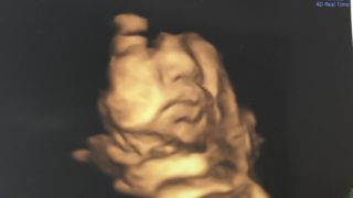 体験談 臨月36週でカンジダ膣炎になった 転妻ライフ